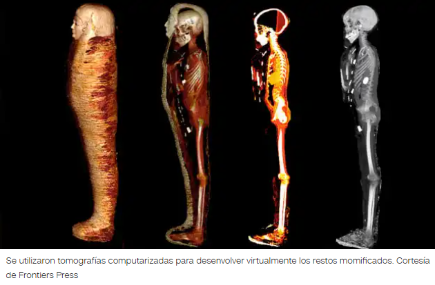 Solo a través de las tomografías la momia reveló todos sus secretos.